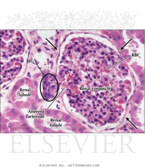 Light Micrograph of a Renal Corpuscle and Its Juxtaglomerular Complex