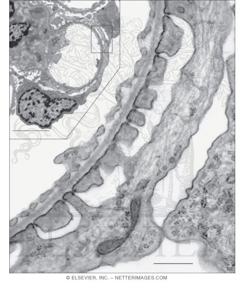 Electron Micrographs of Part of a Renal Corpuscle