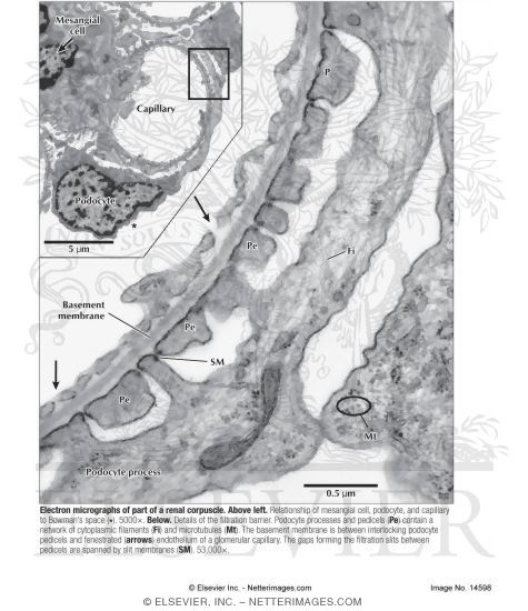 Watermarked preview of labeled image: Electron Micrographs of Part of a Renal Corpuscle