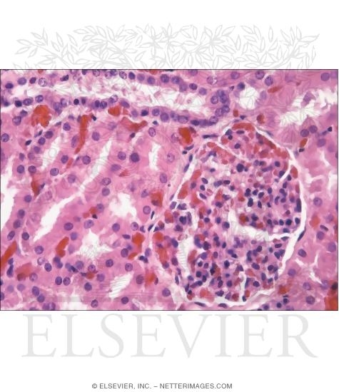 Watermarked preview of unlabeled image: Companion Light Micrograph of Parts of the Renal Cortex