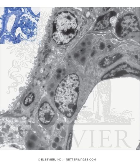 Electron Micrograph Showing Details of the Macula Densa of a Distal Tubule and JG Cells In the Tunica Media of an Afferent Arteriole With Light Micrograph of the JG Complex (in the Box) Near the Vascular Pole of a Renal Corpuscle