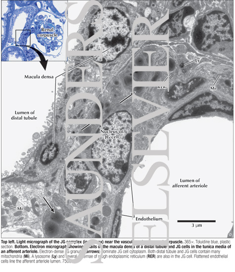 Watermarked preview of labeled image: Electron Micrograph Showing Details of the Macula Densa of a Distal Tubule and JG Cells In the Tunica Media of an Afferent Arteriole With Light Micrograph of the JG Complex (in the Box) Near the Vascular Pole of a Renal Corpuscle