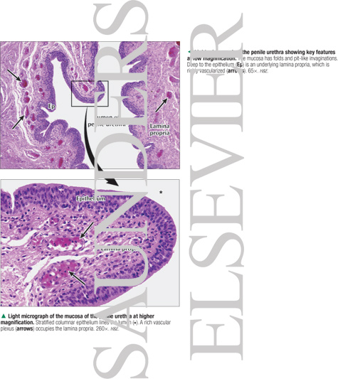 Watermarked preview of labeled image: Light Micrograph of the Penile Urethra Showing Key Features at Low Magnification With Light Micrograph of the Mucosa of the Penile Urethra at Higher Magnification