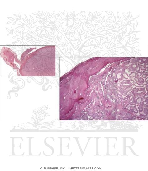 Light Micrograph of Part of the Testis at Low Magnification With Light Micrograph of Testis Showing the Tunica Albuginea and Mediastinum Testis at Low Magnification