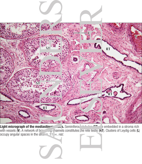 Watermarked preview of labeled image: Light Micrograph of the Mediastinum Testis
