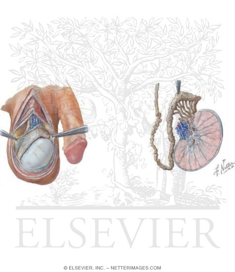 Illustration of Testis, Epididymis and Vas Deferens from the Netter Collection