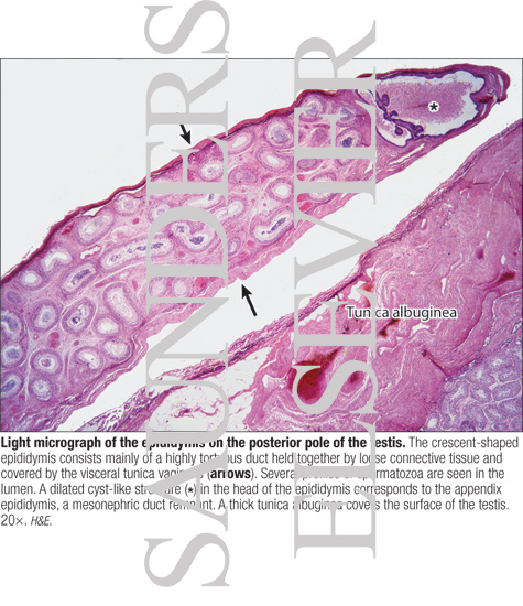 Watermarked preview of labeled image: Light Micrograph of the Epididymis On the Posterior Pole of the Testis