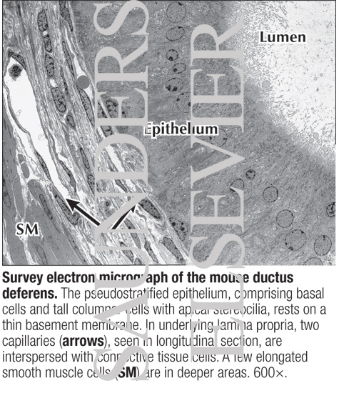 Watermarked preview of labeled image: Survey Electron Micrograph of the Mouse Ductus Deferens