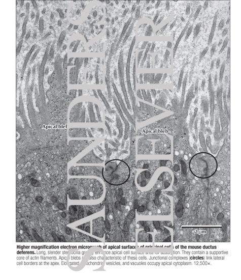 Watermarked preview of labeled image: Higher Magnification Electron Micrograph of Apical Surfaces of Principal Cells of the Mouse Ductus Deferens