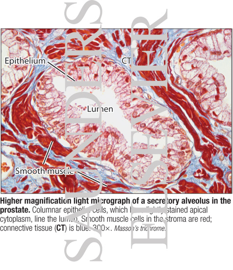 Watermarked preview of labeled image: Higher Magnification Light Micrograph of a Secretory Alveolus In the Prostate