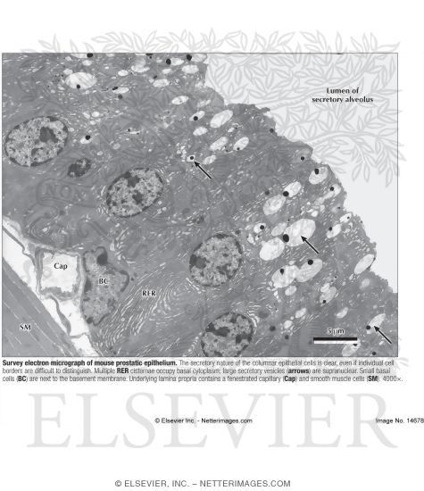 Watermarked preview of labeled image: Survey Electron Micrograph of Mouse Prostatic Epithelium