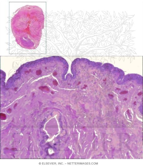 Light Micrograph of the Penis In Transverse Section With Light Micrograph of the Corpus Spongiosum In the Penis