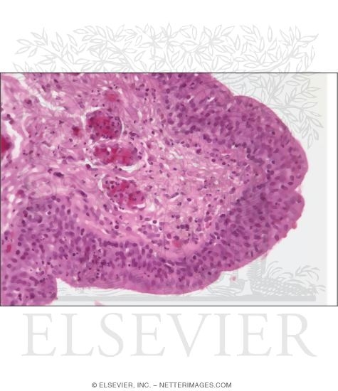 Light Micrograph of the Penile Urethra at Higher Magnification