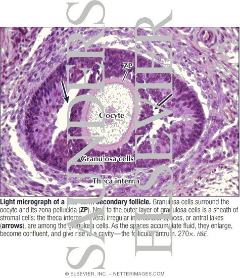 Watermarked preview of labeled image: Light Micrograph of a Late-term Secondary Follicle