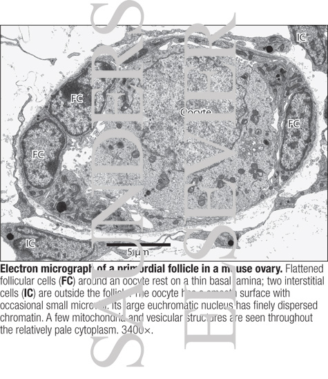 Watermarked preview of labeled image: Electron Micrograph of a Primordial Follicle In a Mouse Ovary