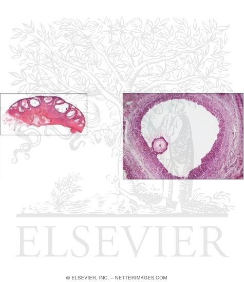 Low-magnification Light Micrograph of a Mature Ovary From a Dog With Light Micrograph of a Graafian Follicle