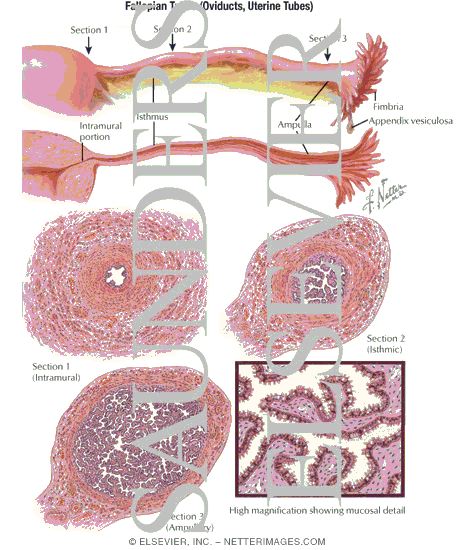 Watermarked preview of labeled image: Fallopian Tubes