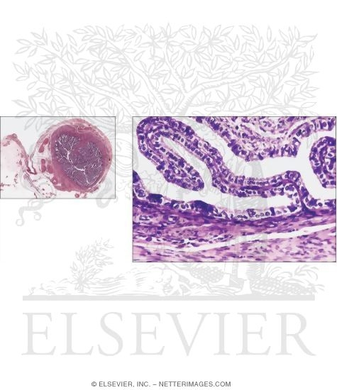 Light Micrograph of a Fallopian Tube at the Level of the Ampulla In Transverse Section With Light Micrograph of Part of a Fallopian Tube Wall