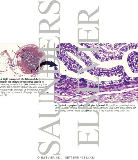 Watermarked preview of labeled image: Light Micrograph of a Fallopian Tube at the Level of the Ampulla In Transverse Section With Light Micrograph of Part of a Fallopian Tube Wall