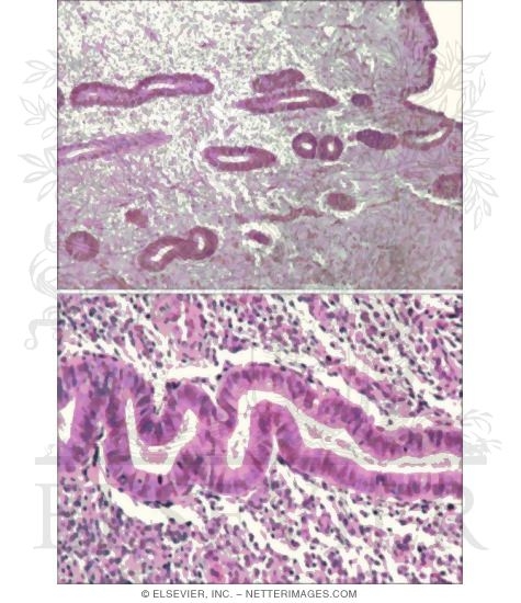 Watermarked preview of unlabeled image: Light Micrographs of the Endometrium During the Early Follicular Phase at Low Magnification (Above) and Late Follicular Phase at Higher Magnification (Below)