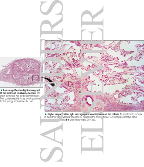 Watermarked preview of labeled image: Low-magnification Light Micrograph of the Clitoris In Transverse Section With Higher Magnification Light Micrograph of Erectile Tissue of the Clitoris