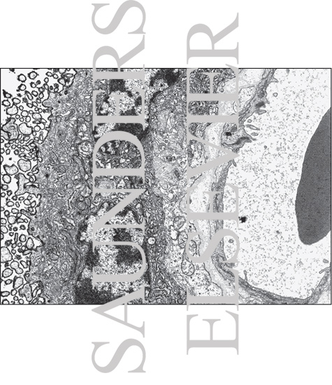 Watermarked preview of unlabeled image: Low-power Electron Micrograph of Part of a Chorionic Villus Showing Main Parts of the Placental Barrier