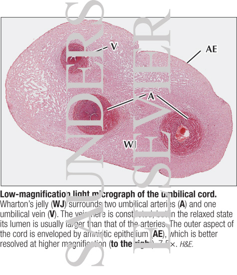 Low-magnification Light Micrograph of the Umbilical Cord