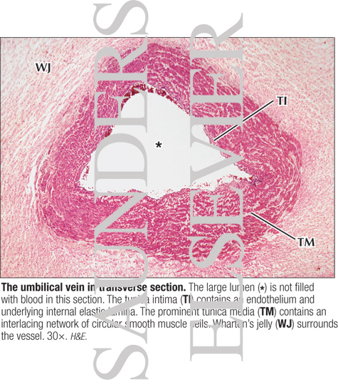 The Umbilical Vein In Transverse Section