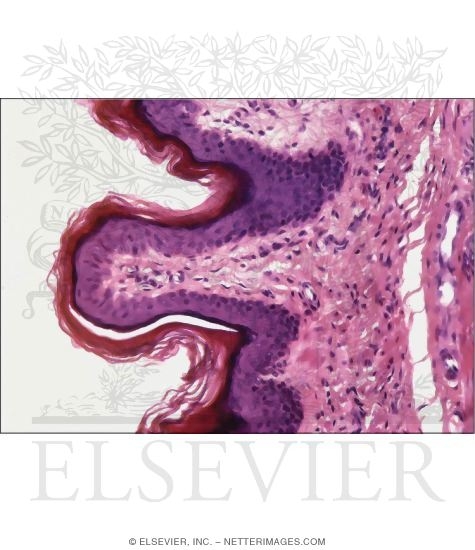 Watermarked preview of unlabeled image: Light Micrograph of the Surface of a Nipple