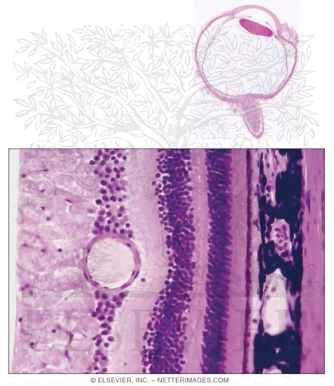 Horizontal Section of the Eyeball Showing Its Main Parts With Light Micrograph Showing the Three Layers of the Eye