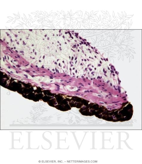 Watermarked preview of unlabeled image: Light Micrograph of the Iris Close to the Pupillary Margin