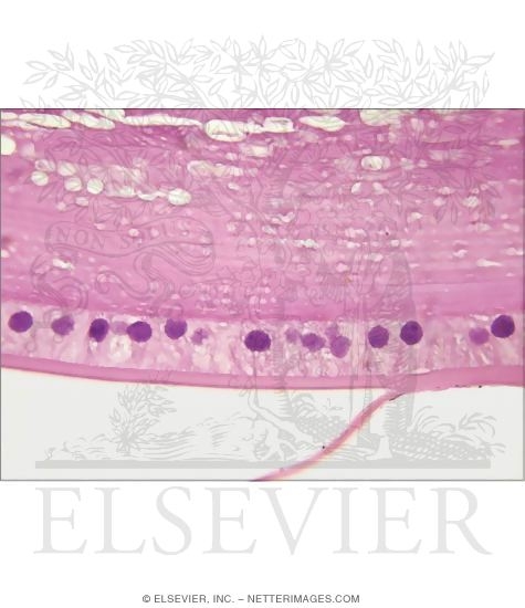 Watermarked preview of unlabeled image: Light Micrograph Showing Details of the Lens From a Child’s Eye at High Magnification