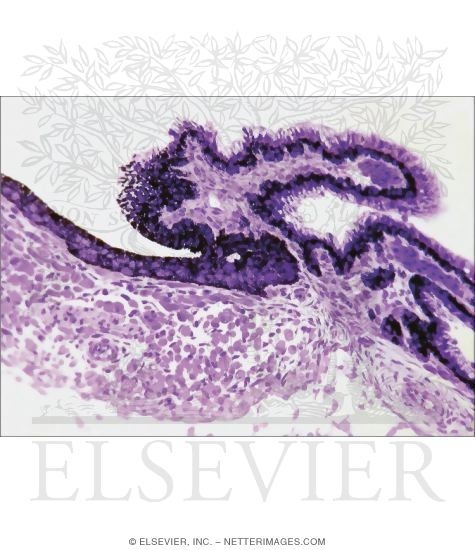 Watermarked preview of unlabeled image: Light Micrograph of Part of the Ciliary Body
