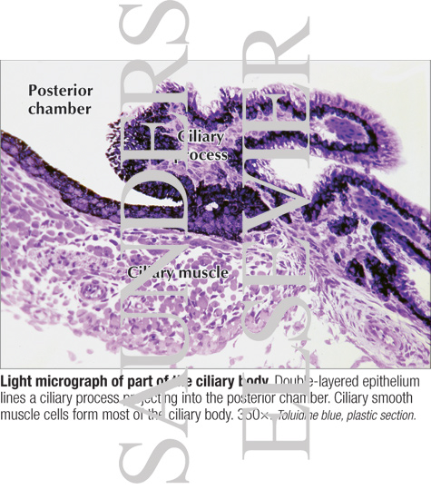 Watermarked preview of labeled image: Light Micrograph of Part of the Ciliary Body