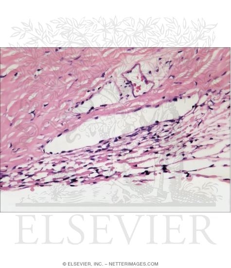 Watermarked preview of unlabeled image: Light Micrograph of the Aqueous Outflow Apparatus