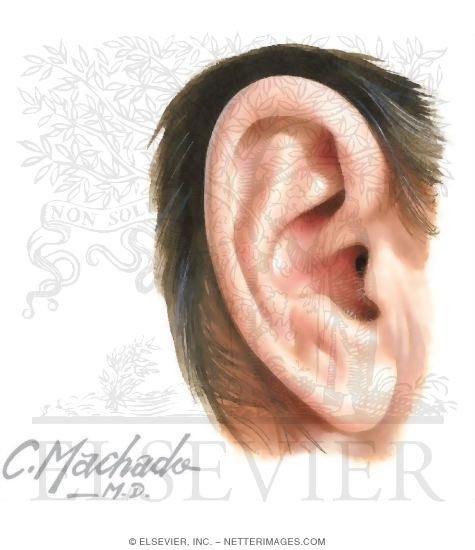Watermarked preview of unlabeled image: Right Auricle