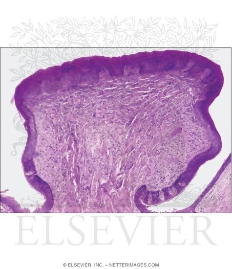 Light Micrograph of a Circumvallate Papilla In the Tongue