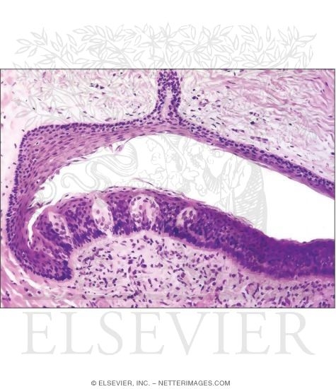 Light Micrograph of the Sulcus (*) of a Circumvallate Papilla