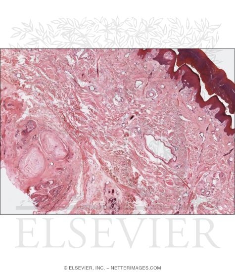 Watermarked preview of unlabeled image: Light Micrograph of Thick Skin