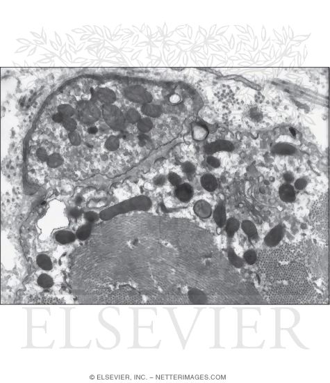Watermarked preview of unlabeled image: Electron Micrograph of a Motor Endplate On an Intrafusal Fiber