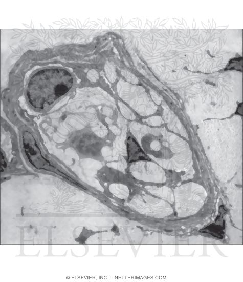 Electron Micrograph of a Golgi Tendon Organ In Transverse Section