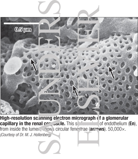 Watermarked preview of labeled image: High-resolution Scanning Electron Micrograph of a Glomerular Capillary In the Renal Corpuscle