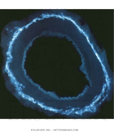 Watermarked preview of unlabeled image: Light Micrograph of a Muscular Artery Treated Histochemically to Demonstrate Innervation