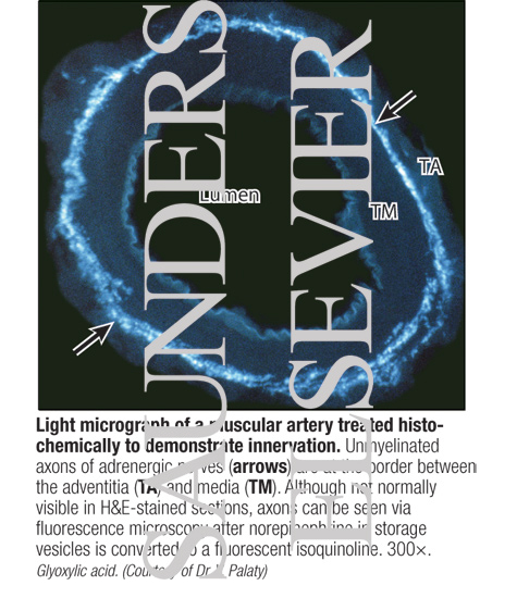 Watermarked preview of labeled image: Light Micrograph of a Muscular Artery Treated Histochemically to Demonstrate Innervation