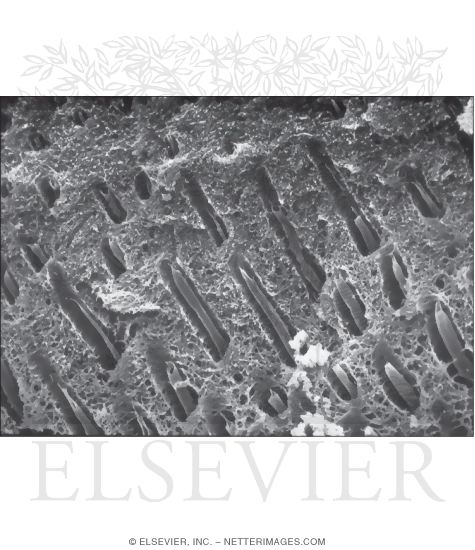 Watermarked preview of unlabeled image: High-resolution Scanning Electron Micrograph of Dentinal Tubules