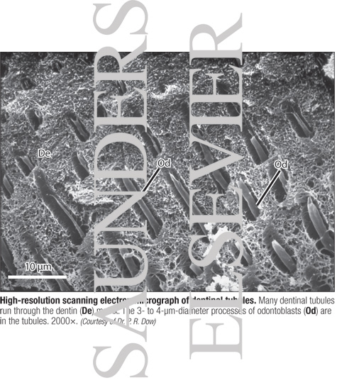 Watermarked preview of labeled image: High-resolution Scanning Electron Micrograph of Dentinal Tubules