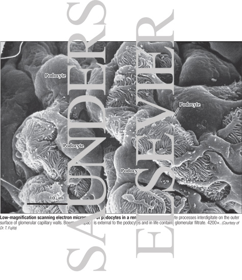 Low-magnification Scanning Electron Micrograph of Podocytes In a Renal Corpuscle
