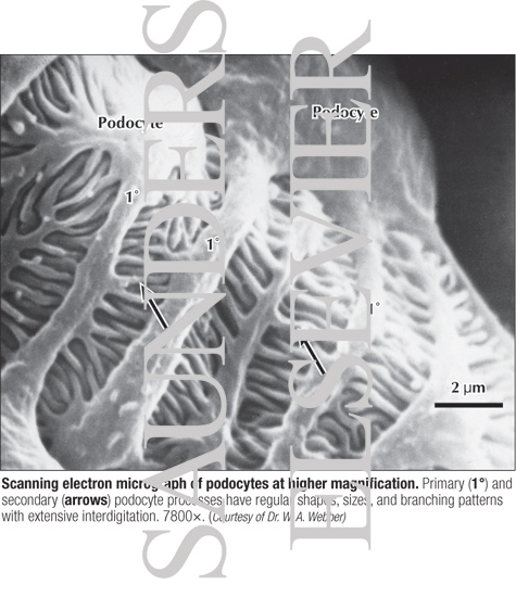 Scanning Electron Micrograph of Podocytes at Higher Magnification