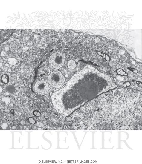 Watermarked preview of unlabeled image: Electron Micrograph of the Juxtanuclear Region of an Early Spermatid