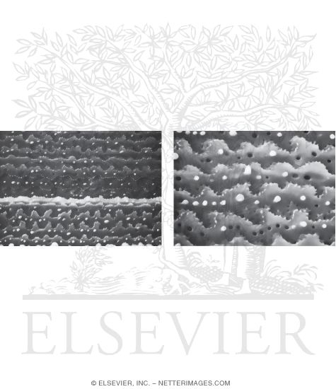 Watermarked preview of unlabeled image: Scanning Electron Micrographs Showing Mature Lens Fibers at Low (Left) and High (Right) Magnification